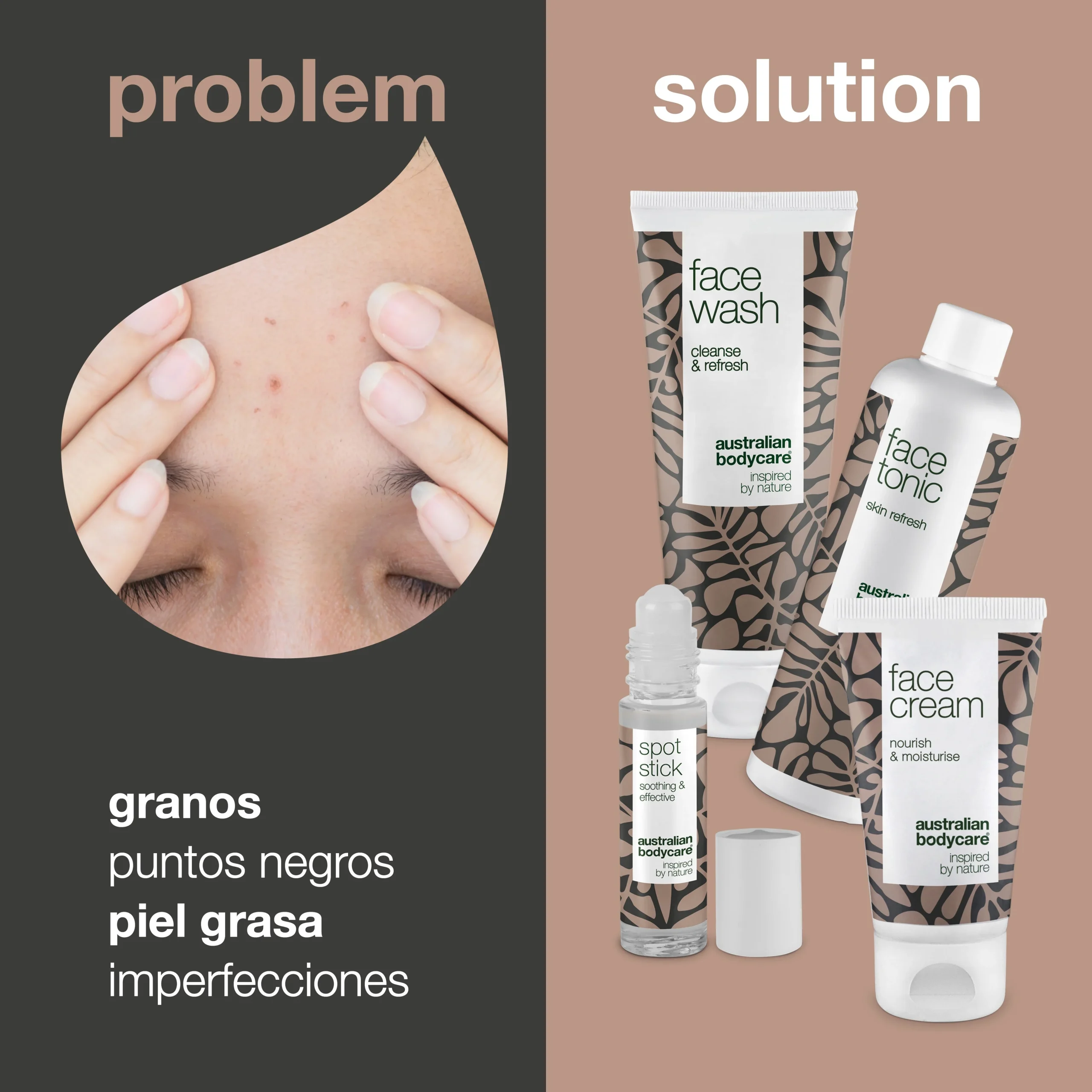 Kit de 4 productos para el cuidado Facial  — Para granos, puntos negros y espinillas en la cara