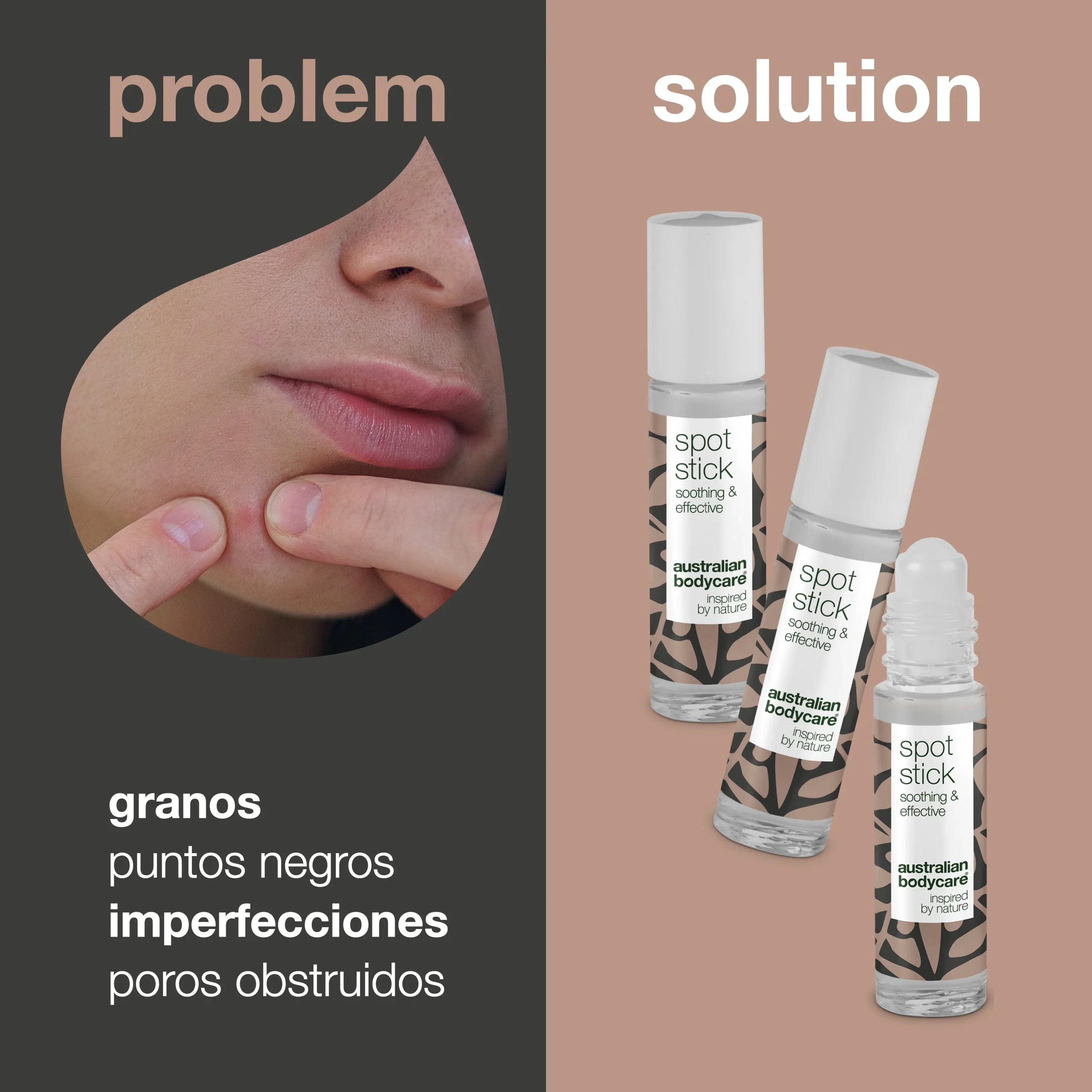 3 x Spot Stick Roll con aceite de árbol de té para granos y puntos negros — Eficaz contra granos, impurezas y puntos negros.