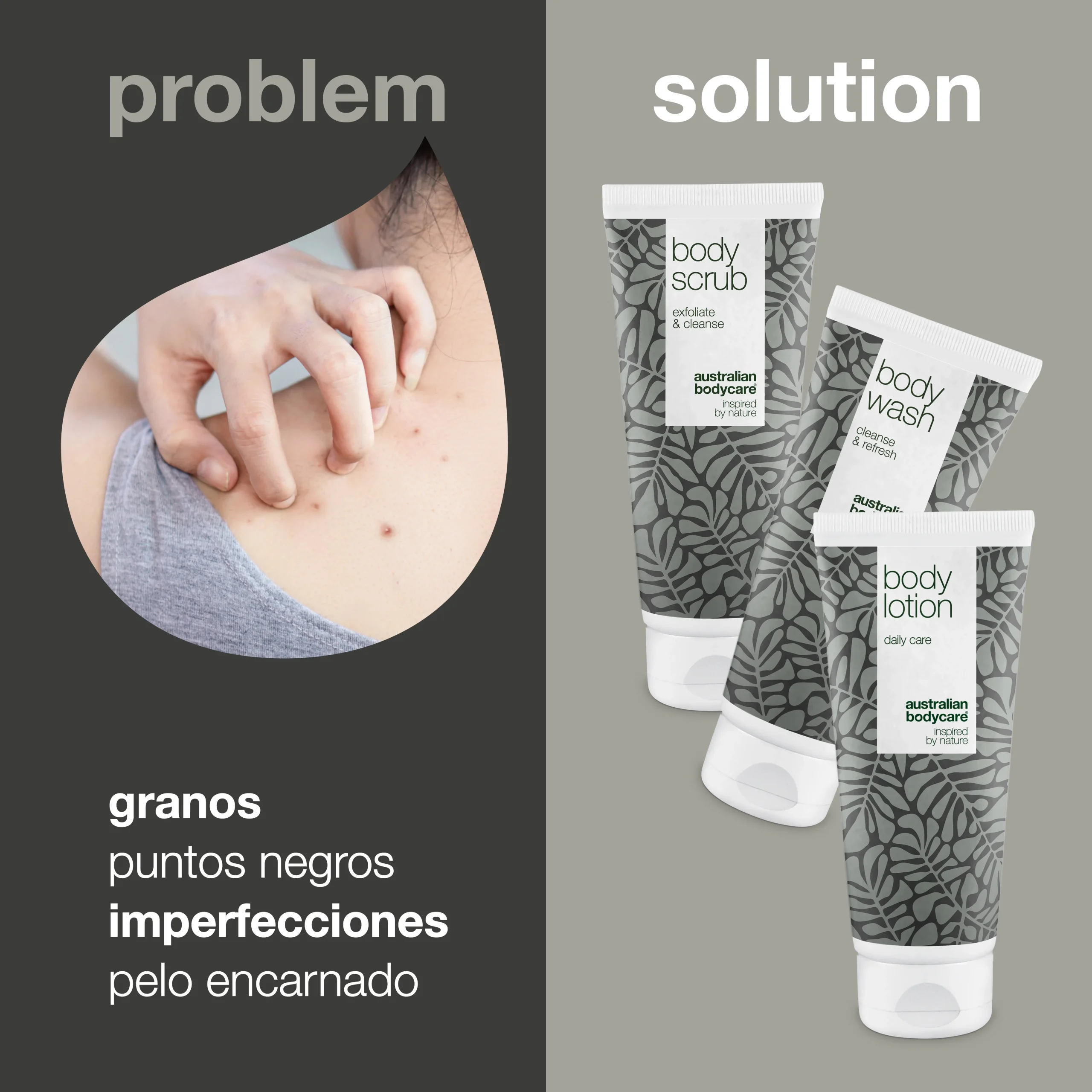 3 productos para manchas, acné y puntos negros en la espalda y glúteos — 3 productos con aceite natural del árbol del té