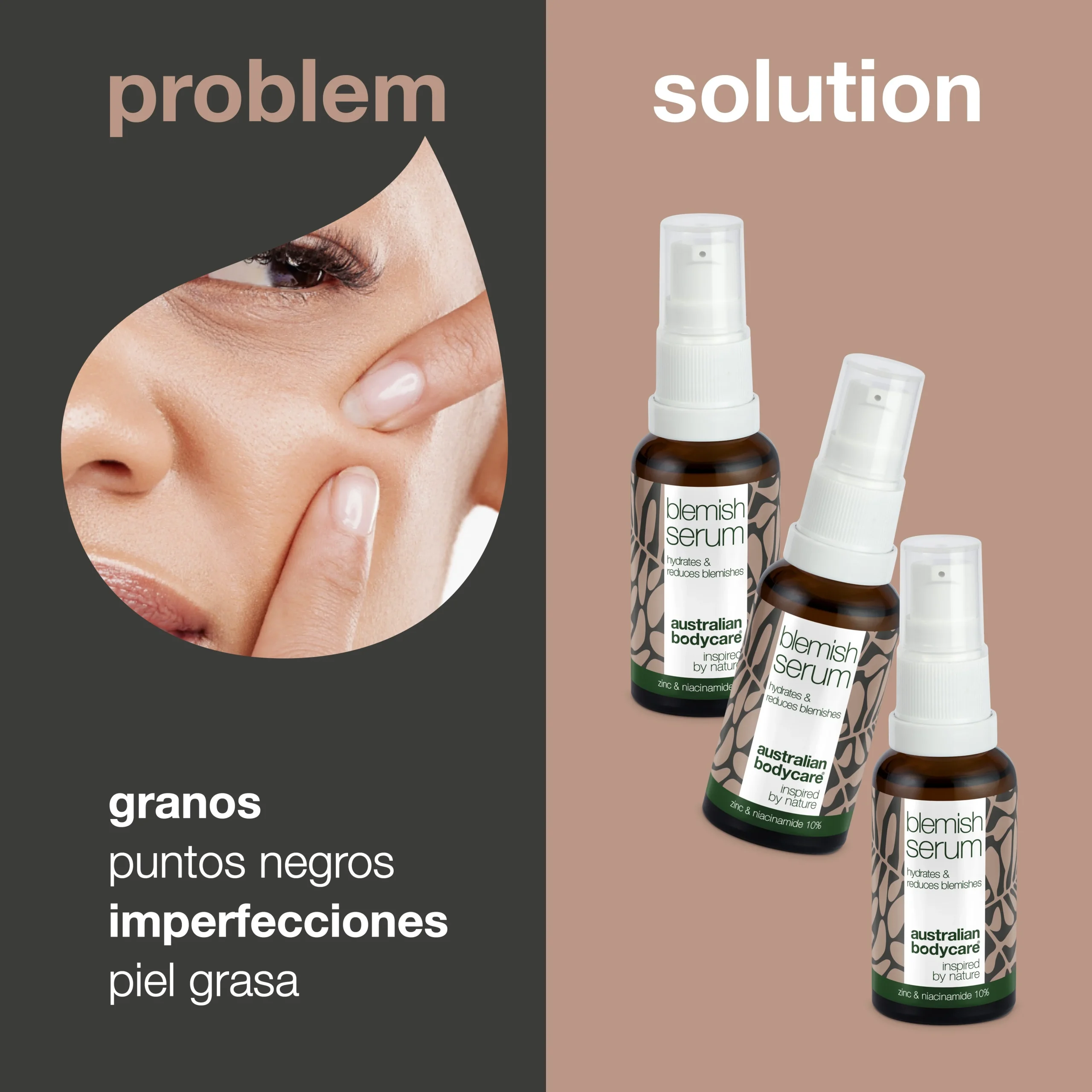 3 x Sérums de Niacinamida para granos y puntos negros — con Niacinamida 10%, Zink 1% y Aceite de Árbol de Té para pieles grasas con manchas.