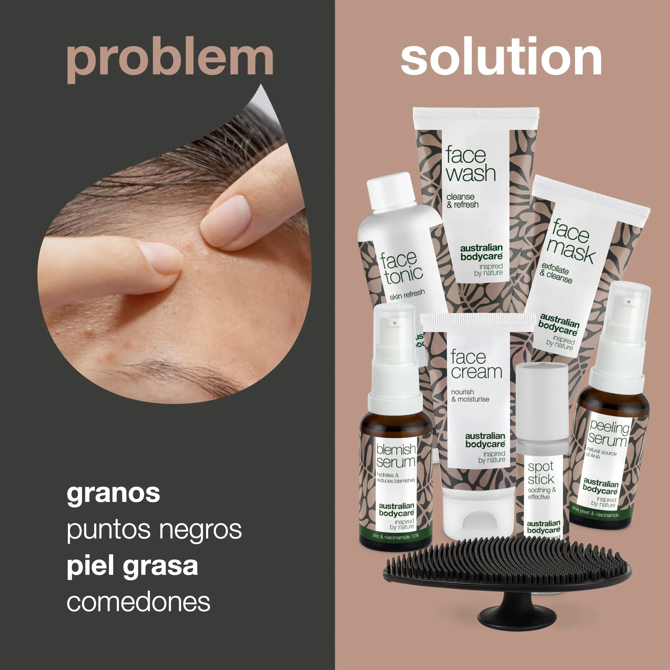 8 productos faciales para espinillas y manchas — Cuidado de la piel grasa y poros obstruidos