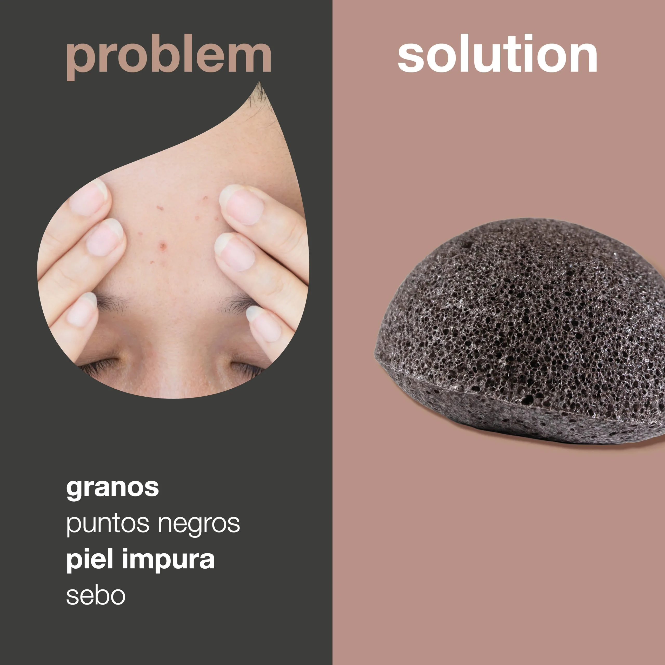 Esponja konjac para imperfecciones de la piel — Esponja Konjac para exfoliación natural de granos y puntos negros