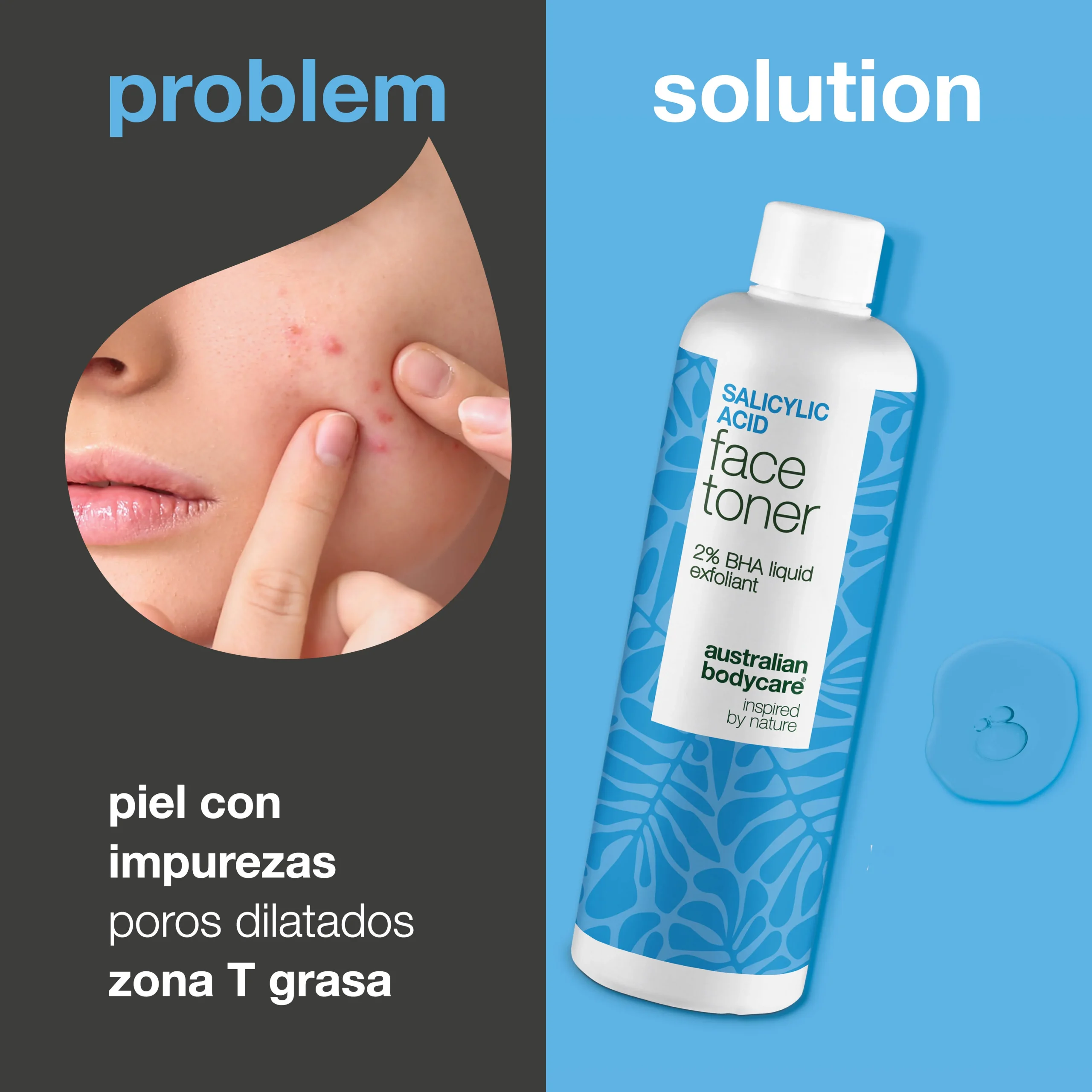 Tonico all’acido salicilico per acne e pori dilatati — Peeling all’acido salicilico purifica i pori, riduce acne e lucidità. Ideale per pelle mista o impura.