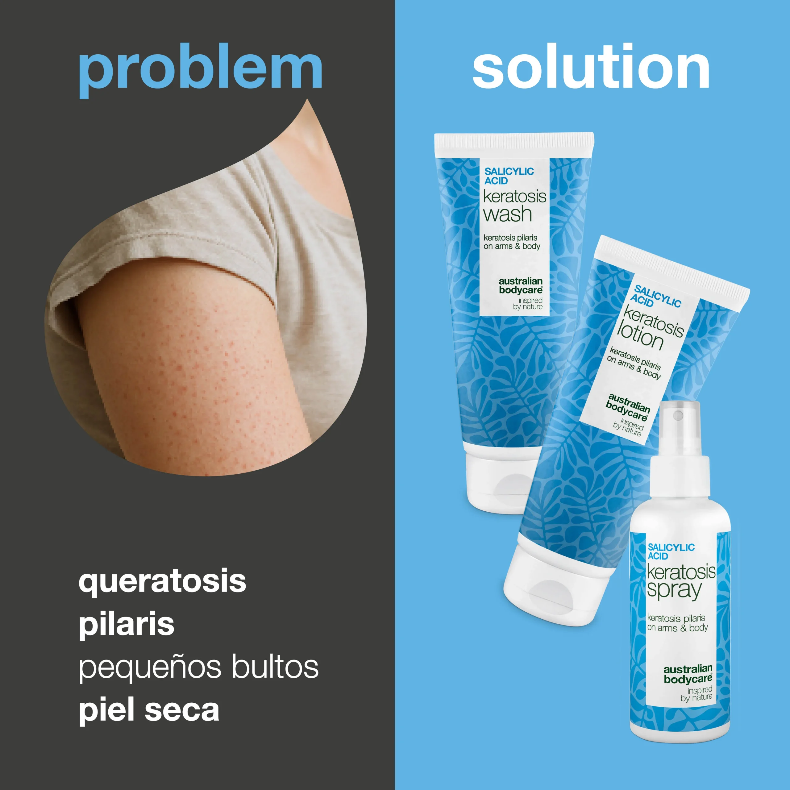Pack Queratosis Pilaris – Suaviza piel seca y rugosa — Tratamiento corporal contra la Queratosis Pilaris reduce la piel rugosa y con textura irregular para una piel suave.